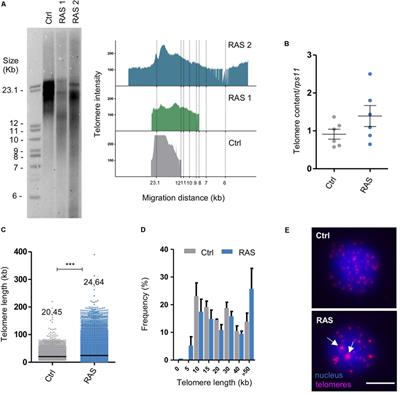 Expression of tert Prevents ALT in Zebrafish Brain Tumors